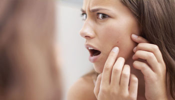 Acne Free Skin Care Products